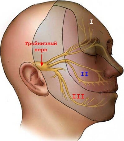 Невралгия тройничного нерва