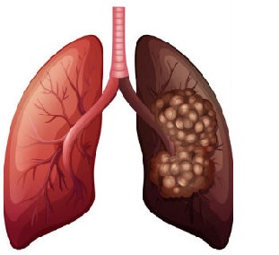 Тамоку зиёнбахши саломатии инсон