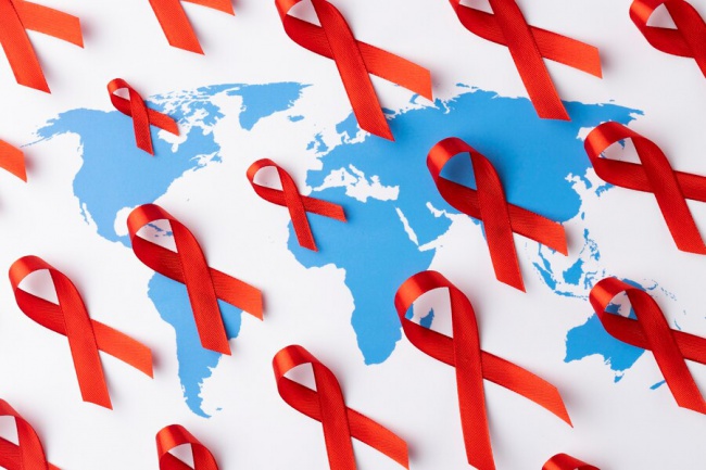 Hiv/aids - an infection that causes damage to the body's immune system