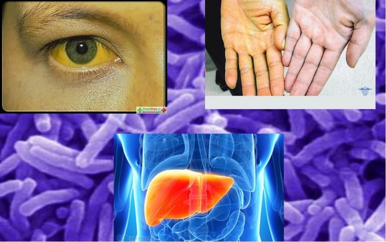 NATION’S HEALTH IS THE MAIN WEALTH OF THE STATE