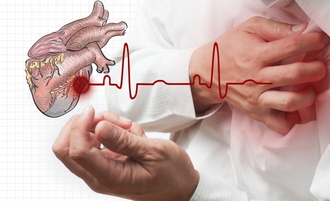 THE IMPACT OF PROFESSIONAL ACTIVITY ON THE DEVELOPMENT OF CARDIOVASCULAR DISEASES